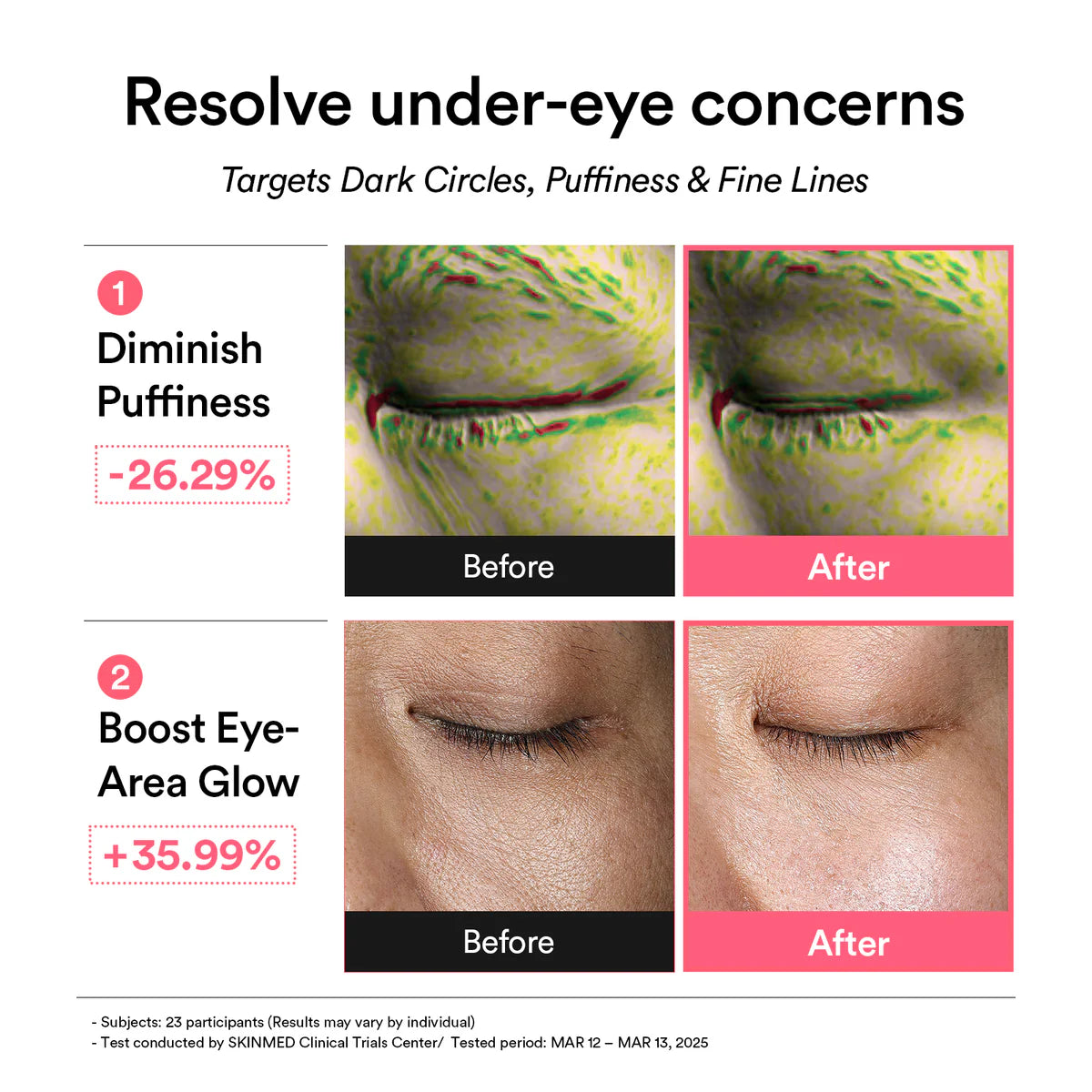 PDRN Retinal Eye Patch/Glow Jelly