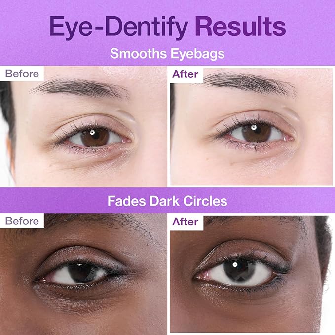 No.9 NAD+ Collagen Under Eye Patches