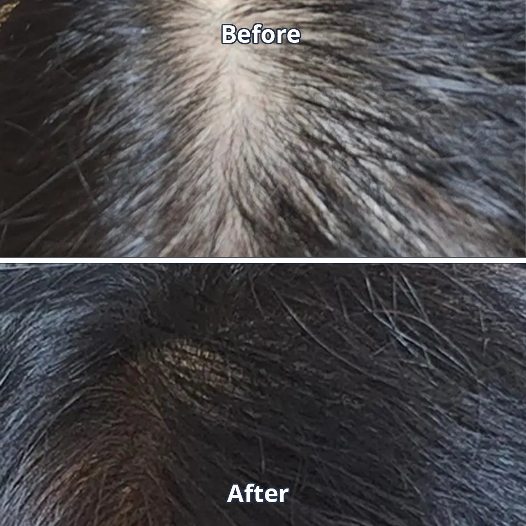 Scalp Spioxyl React Shot 800