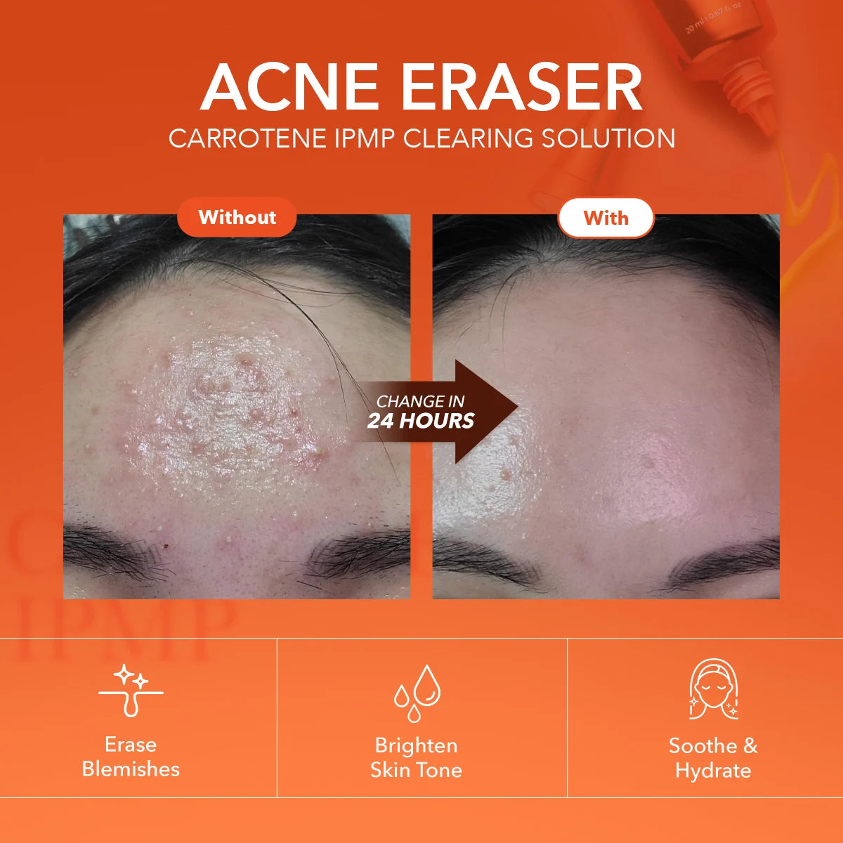 APRILSKIN Carrotene IPMP Clearing Solution
