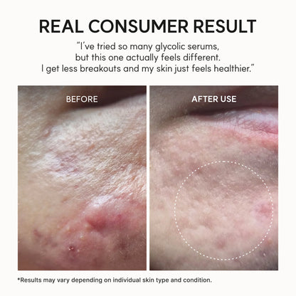 Eraser Shot Glycolic Acid Booster