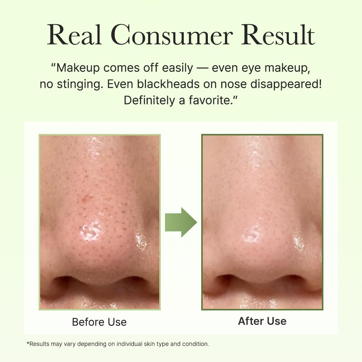 Pore Melt Phyto PDRN Cleansing Balm