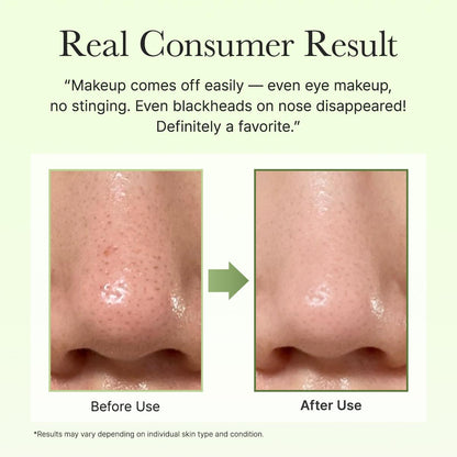 Pore Melt Phyto PDRN Cleansing Balm