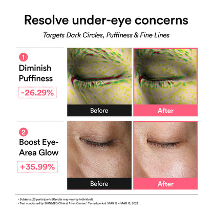 PDRN Retinal Eye Patch/Glow Jelly