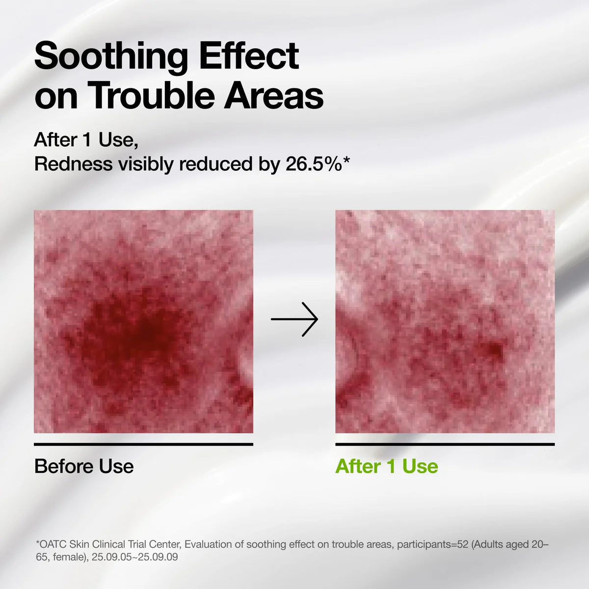 Anua Azelaic Acid CICA Skin Soothing Moisturizer