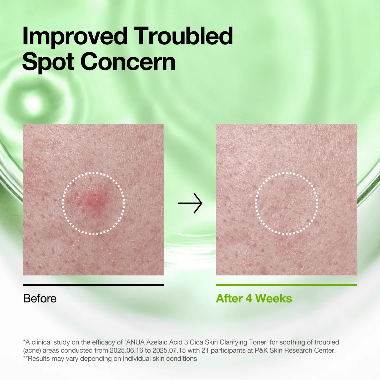 Azelaic Acid 3 Cica Skin Clarifying Toner