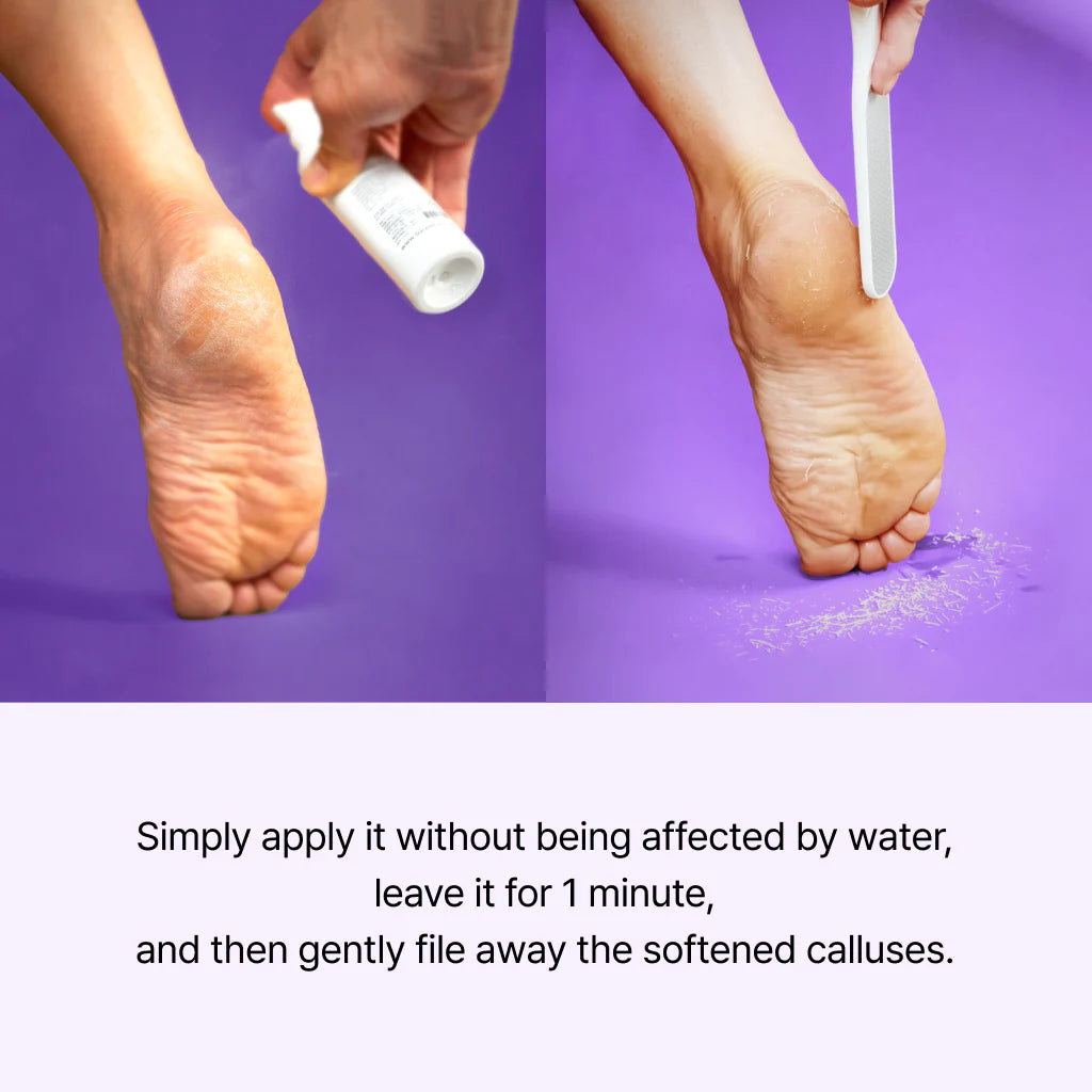 Callus Remover Peeling Foot Spray