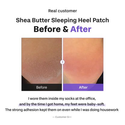 Shea Butter Sleeping Heel Patch