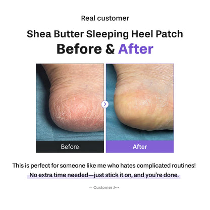 Shea Butter Sleeping Heel Patch