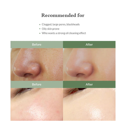 Premium Quick Step Sebum Cleanser