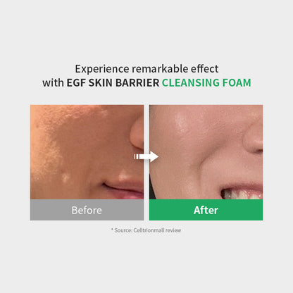 EGF Skin Barrier Cleansing Foam
