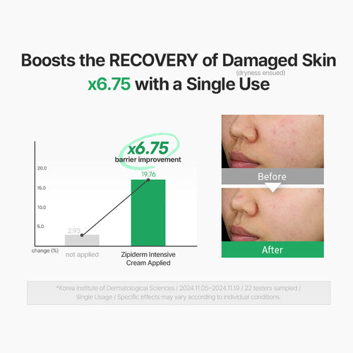 Zipiderm EGF Skin Barrier Intensive Cream