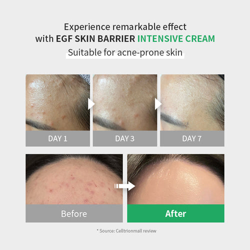 Zipiderm EGF Skin Barrier Intensive Cream