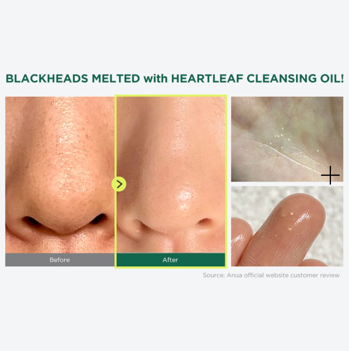 Heartleaf Pore Control Cleansing Oil