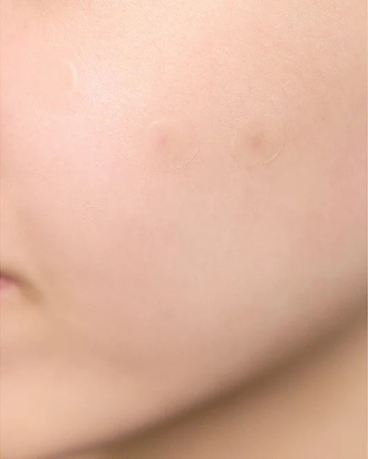 SKIN1004 Spot Cover Patch
