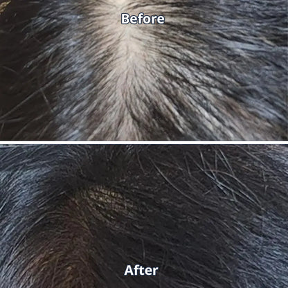 Scalp Spioxyl React Shot 800